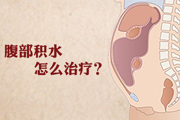 腹部积水怎么治疗