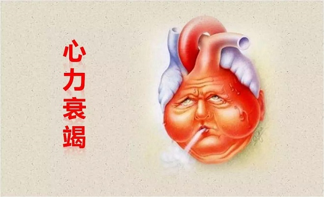 什么原因能引起心衰