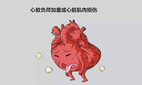 心衰需要做哪些检查