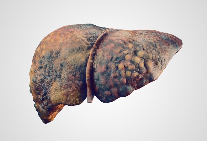 腹腔有积液中医方法